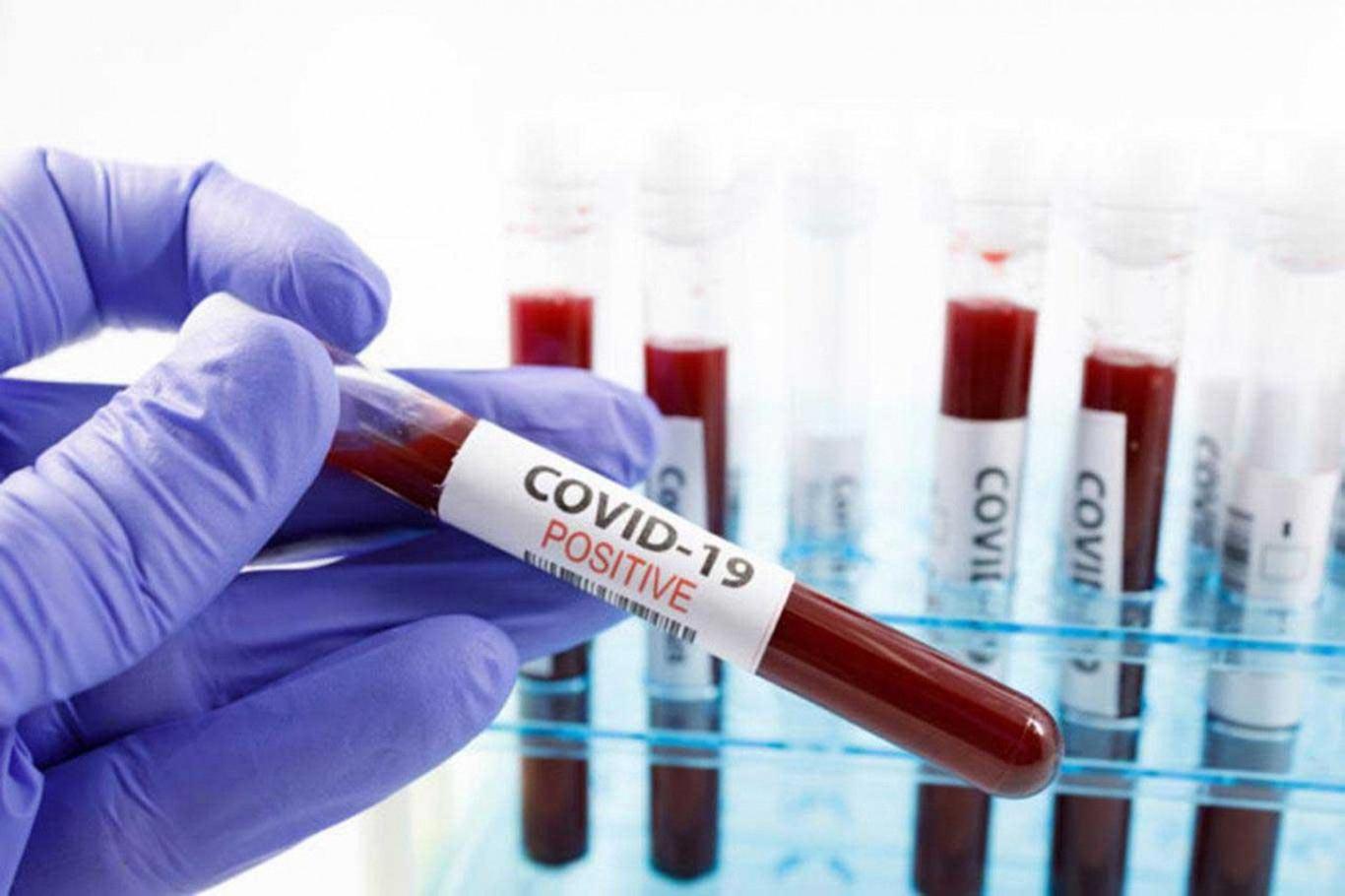 Fransa Halk Sağlığı Kurumu: Bildirilen Coronavirus vakaları gerçek sayının çok altında